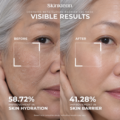 Ceramide Beta-Glucan®  Barrier Gel Mask