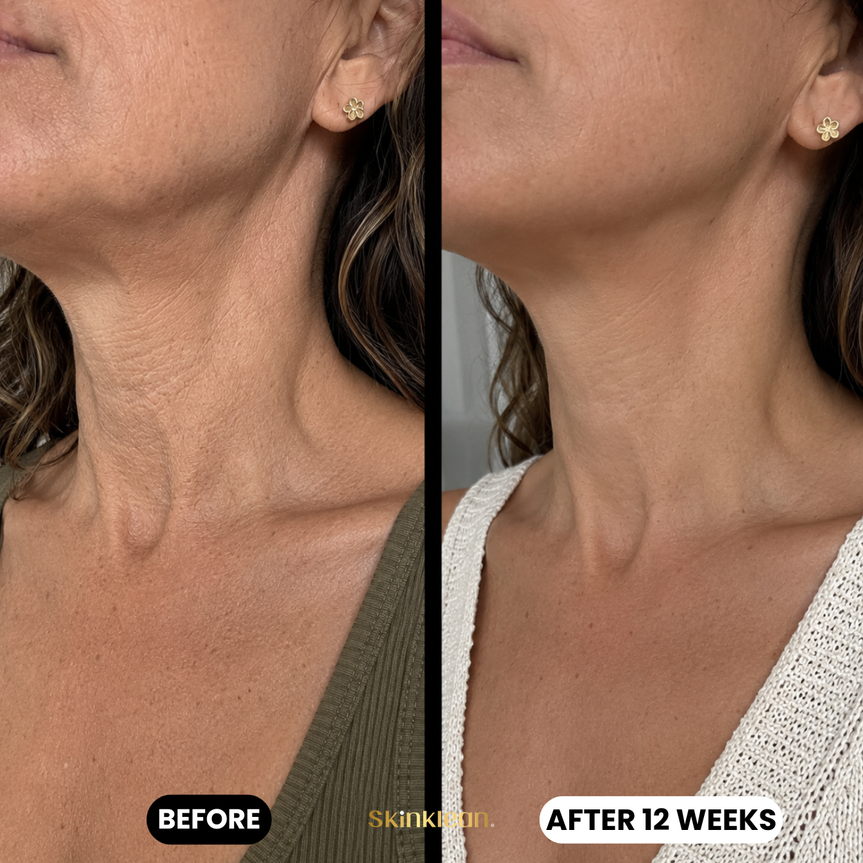 Baby Collagen NECK Mask