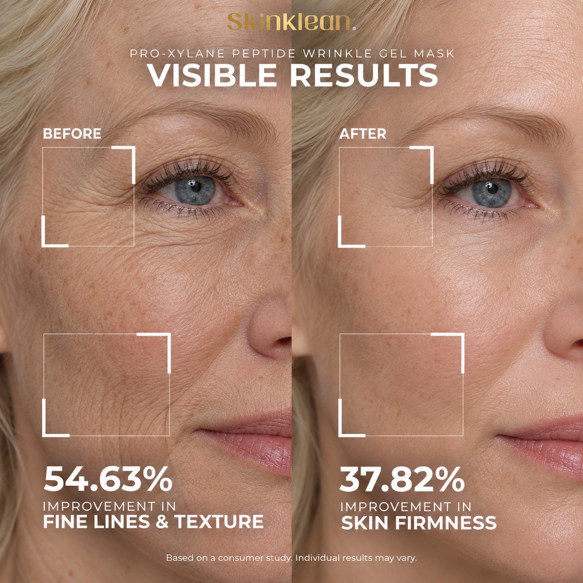 Pro-Xylane Peptide® Wrinkle Gel Mask