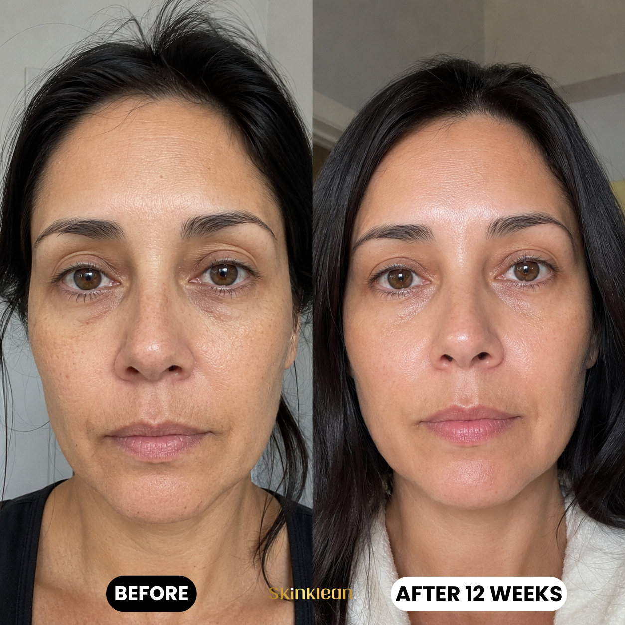 Hyaluronic Acid Serum