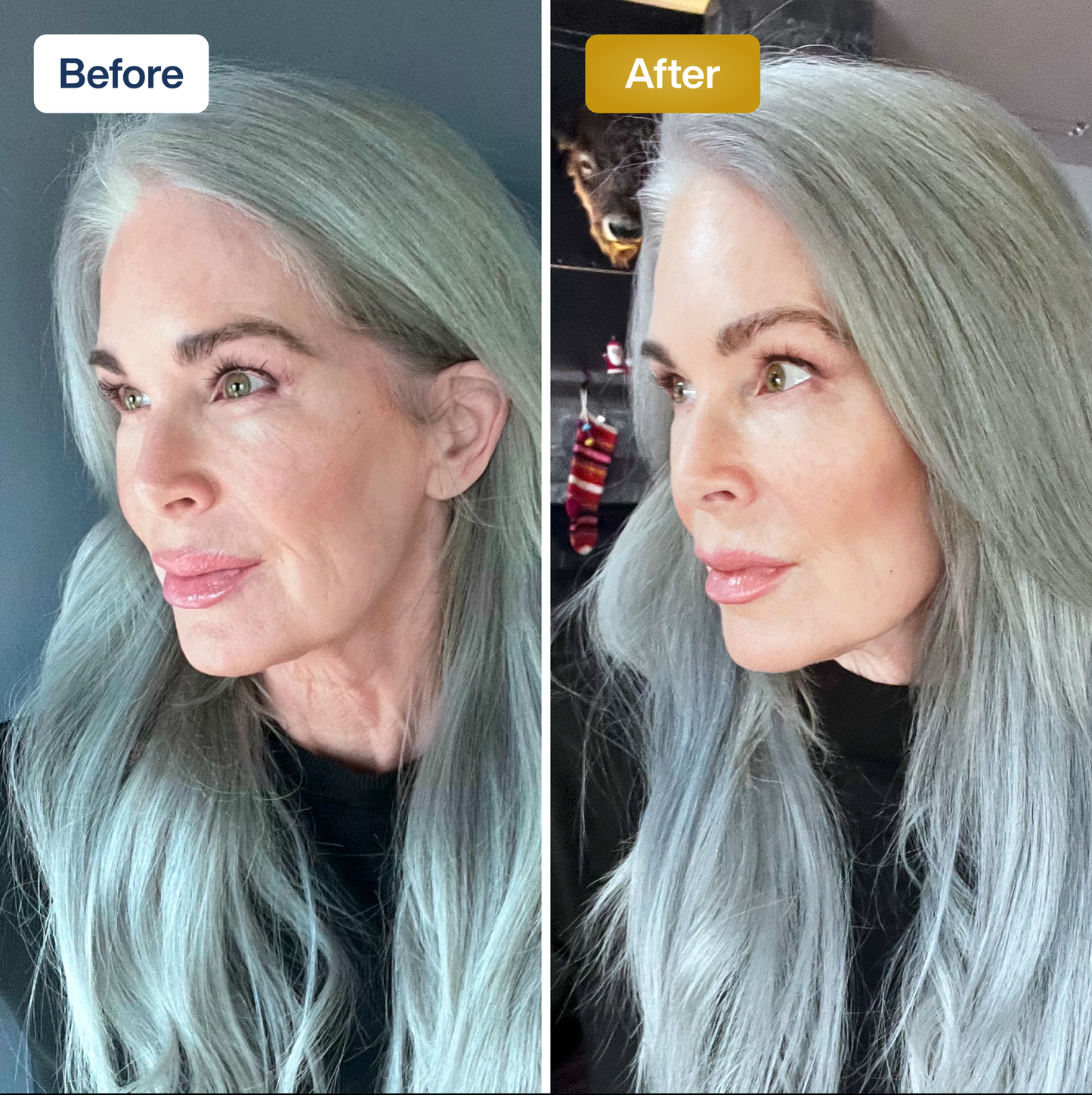 Mascarilla facial de colágeno SkinKlean©