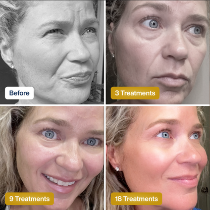 Mascarilla facial de colágeno SkinKlean©