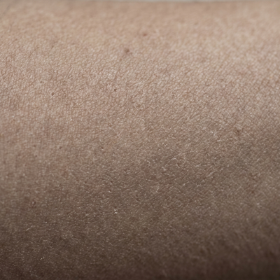 Dull-looking skin